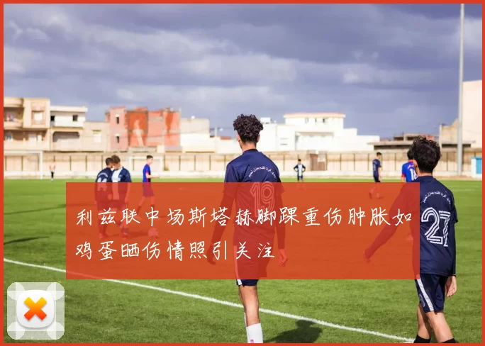利兹联中场斯塔赫脚踝重伤肿胀如鸡蛋晒伤情照引关注